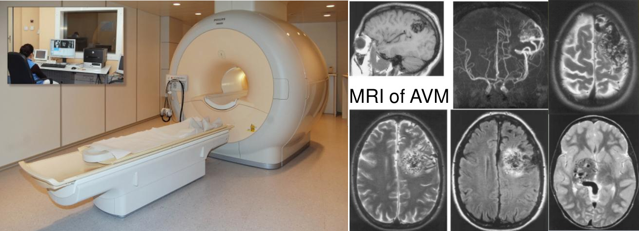 MRI