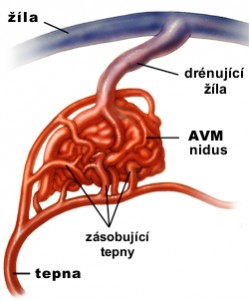 obr_AVM